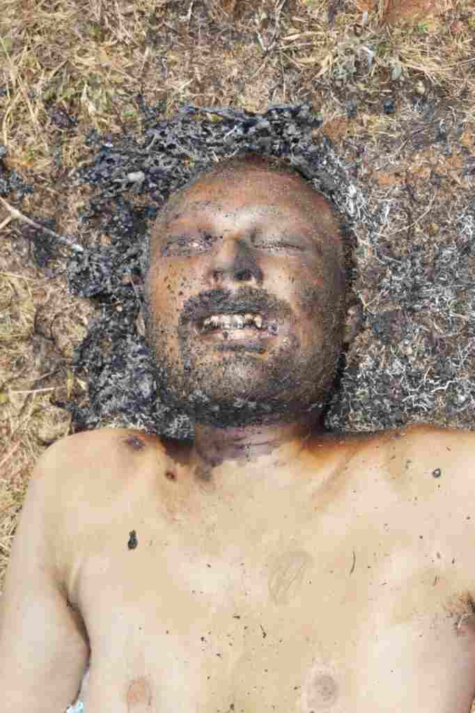 Attempt to Murder and burn face in Akole taluka