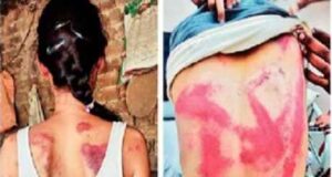 Female lawyer brutally beaten up