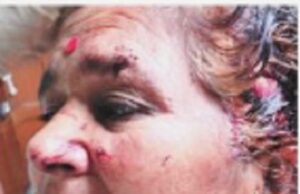 Two children rescue mother from bibatya attack